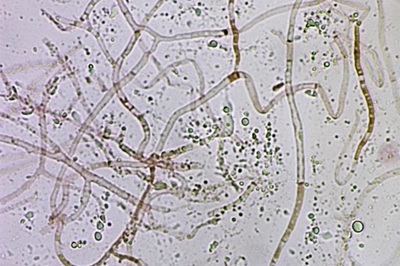 ditangium-cerasi12