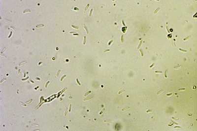 ditangium-cerasi6