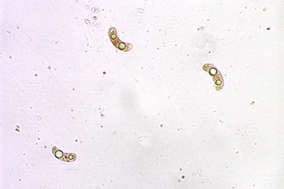 exidia-glandulosa10