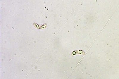 exidia-glandulosa9