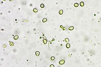 fistulina-hepatica11