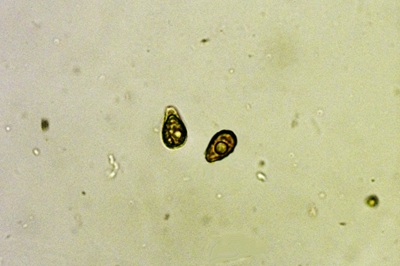 ganoderma-pfeifferi10