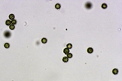 geastrum-michelianum11
