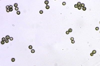 geastrum-michelianum12
