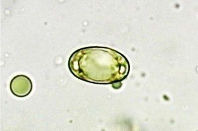 helvella-crispa5