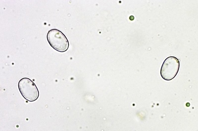 helvella-crispa6