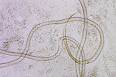 hemitrichia-clavata11