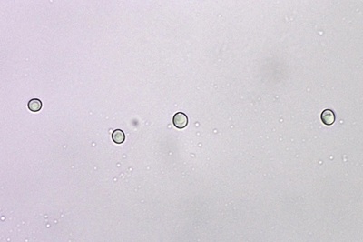 hericium-erinaceus11
