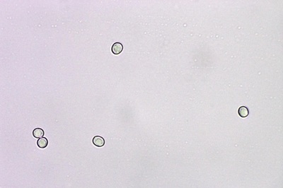 hericium-erinaceus12