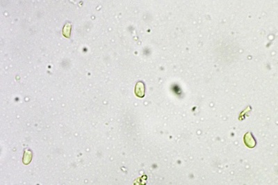 hohenbuehelia-petaloides10