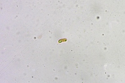 hydropodia-subalpina6