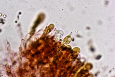 hydropodia-subalpina8