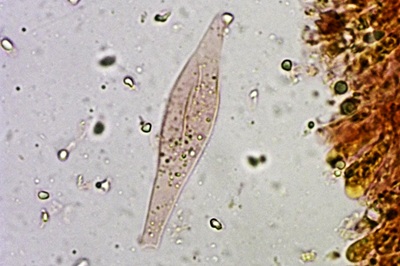 hydropodia-subalpina9