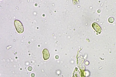 hygrocybe-acutoconica10