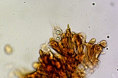 hygrocybe-acutoconica11