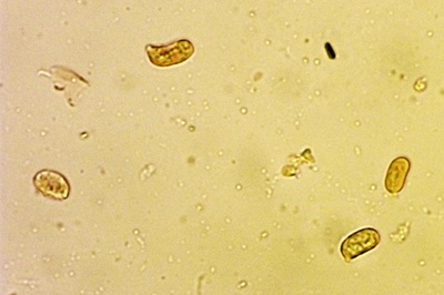 hygrocybe-acutoconica8