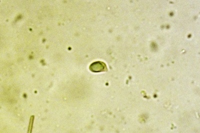 hygrophorus-eburneus11