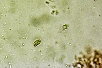 hygrophorus-eburneus12