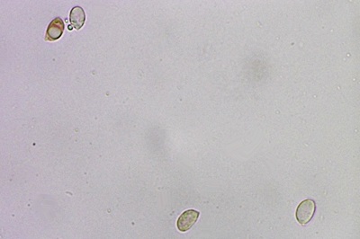 hygrophorus-hypothejus8