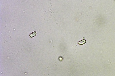 hygrophorus-lindtneri11