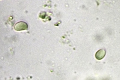 hygrophorus-nemoreus6
