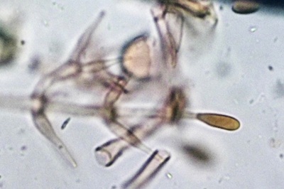 hypomyces-hyalinus11