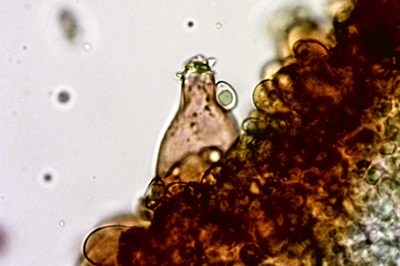 inocybe-posterula11