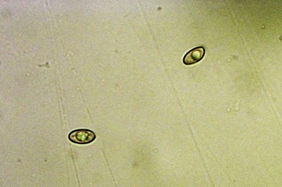 inocybe-posterula7