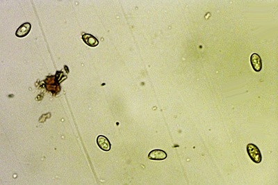 inocybe-posterula8