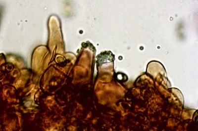 inocybe-posterula9