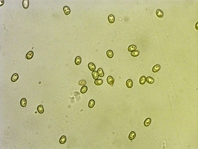 inonotus-cuticularis6
