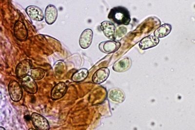 inosperma-maculatum12