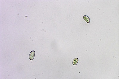 inosperma-maculatum7