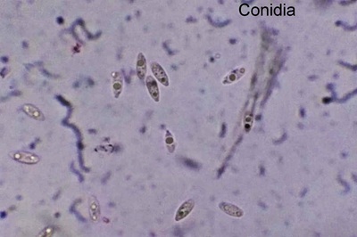 kretzschmaria-deusta12