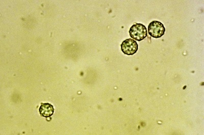 laccaria-amethystina12