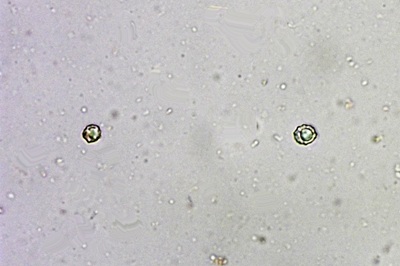 lactarius-zonarius8