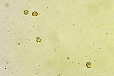 laetiporus-sulphureus10