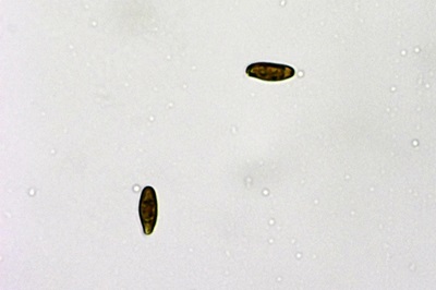 leccinum-scabrum5