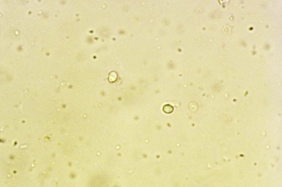 lentinellus-ursinus7