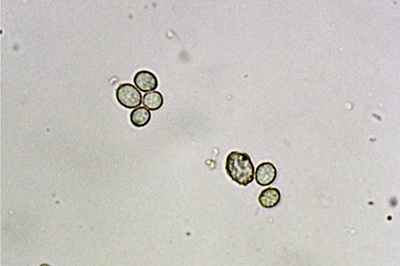 leucopaxillus-gentianeus10