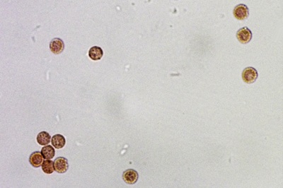 lycogala-epidendrum11