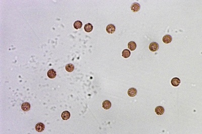 lycogala-epidendrum12