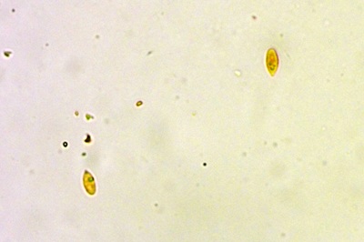 marasmius-rotula5