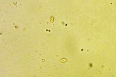 metuloidea-fragrans10