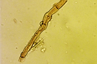 mollisia-cinerea12