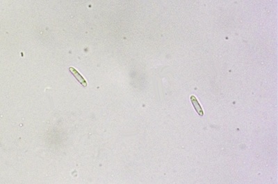 mollisia-cinerea6