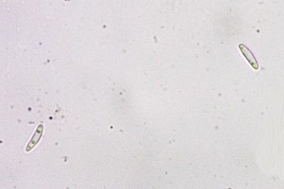 mollisia-cinerea7