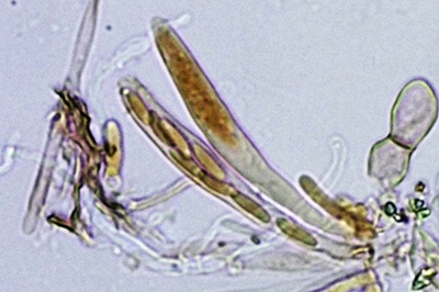 mollisia-cinerea8