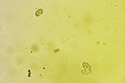 mycena-renati7