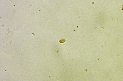 mycena-tintinnabulum8